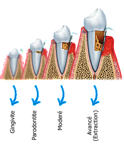 parontodologie